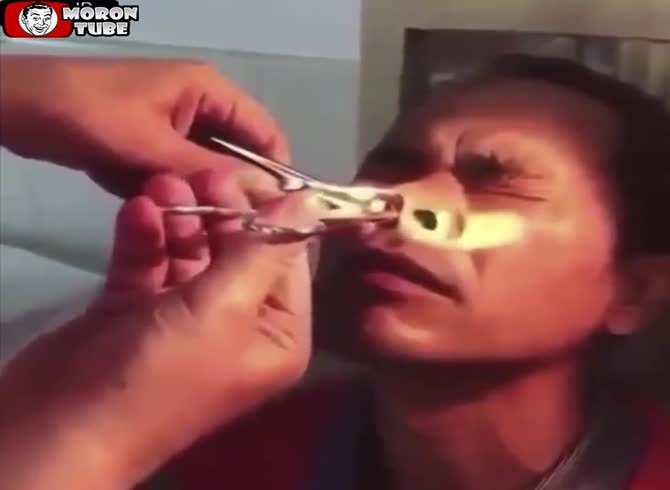 Video :A man's nostrils emitted a terrifying sound